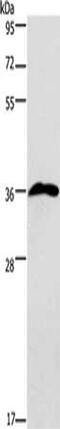 Ribose-phosphate pyrophosphokinase 1 antibody, CSB-PA583001, Cusabio, Western Blot image 