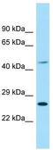 Eukaryotic Translation Initiation Factor 4E Family Member 1B antibody, TA334103, Origene, Western Blot image 