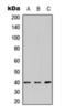 Arginine Vasopressin Receptor 2 antibody, orb393221, Biorbyt, Western Blot image 
