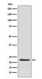 Chorionic somatomammotropin hormone antibody, M05177, Boster Biological Technology, Western Blot image 