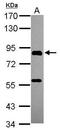 PiggyBac Transposable Element Derived 1 antibody, GTX119509, GeneTex, Western Blot image 