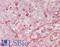 Superoxide Dismutase 3 antibody, LS-B14600, Lifespan Biosciences, Immunohistochemistry paraffin image 