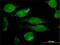 Granulin Precursor antibody, H00002896-M01, Novus Biologicals, Immunocytochemistry image 