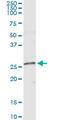 NME/NM23 Family Member 5 antibody, LS-C198553, Lifespan Biosciences, Immunoprecipitation image 