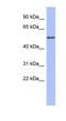 Tubulin Alpha 4a antibody, NBP1-53162, Novus Biologicals, Western Blot image 