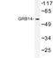 Growth Factor Receptor Bound Protein 14 antibody, LS-C177377, Lifespan Biosciences, Western Blot image 