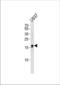 IQ Motif Containing F6 antibody, TA328164, Origene, Western Blot image 