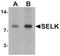 Selenoprotein K antibody, orb75825, Biorbyt, Western Blot image 