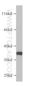 Tubulin Folding Cofactor C antibody, 15917-1-AP, Proteintech Group, Western Blot image 