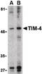 T Cell Immunoglobulin And Mucin Domain Containing 4 antibody, PA5-20246, Invitrogen Antibodies, Western Blot image 