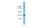 Chromatin Target Of PRMT1 antibody, PA5-44307, Invitrogen Antibodies, Western Blot image 