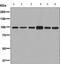 Fibroblast Growth Factor Receptor 3 antibody, ab133644, Abcam, Western Blot image 