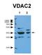 Voltage Dependent Anion Channel 2 antibody, orb329810, Biorbyt, Western Blot image 