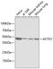 Actin Gamma 1 antibody, 18-745, ProSci, Western Blot image 