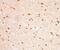 IDH antibody, 34074, QED Bioscience, Immunohistochemistry paraffin image 