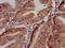 RALBP1 Associated Eps Domain Containing 1 antibody, LS-C674156, Lifespan Biosciences, Immunohistochemistry paraffin image 