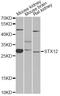 Syntaxin 12 antibody, A8200, ABclonal Technology, Western Blot image 
