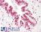 p53 antibody, LS-B7579, Lifespan Biosciences, Immunohistochemistry paraffin image 