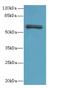 Family With Sequence Similarity 222 Member B antibody, A66978-100, Epigentek, Western Blot image 