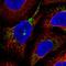 GTP Binding Protein 8 (Putative) antibody, HPA058631, Atlas Antibodies, Immunofluorescence image 