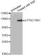 Protein Tyrosine Kinase 2 antibody, STJ22353, St John