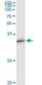 Exosome Component 3 antibody, H00051010-M03, Novus Biologicals, Immunoprecipitation image 