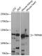 Transient Receptor Potential Cation Channel Subfamily M Member 8 antibody, 14-517, ProSci, Western Blot image 