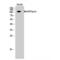 MER Proto-Oncogene, Tyrosine Kinase antibody, LS-C384508, Lifespan Biosciences, Western Blot image 