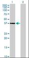 Cyclin Dependent Kinase 6 antibody, orb94628, Biorbyt, Western Blot image 