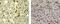 Thrombomodulin antibody, 17-1419-41, Invitrogen Antibodies, Immunohistochemistry paraffin image 