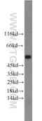 Egl-9 Family Hypoxia Inducible Factor 2 antibody, 12984-1-AP, Proteintech Group, Western Blot image 