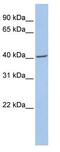 Fibromodulin antibody, ab81443, Abcam, Western Blot image 