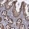 KRAS Proto-Oncogene, GTPase antibody, NBP2-33579, Novus Biologicals, Immunohistochemistry paraffin image 