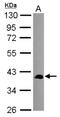 SEC14 Like Lipid Binding 2 antibody, NBP2-15111, Novus Biologicals, Western Blot image 