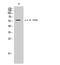 Erythrocyte Membrane Protein Band 4.1 antibody, STJ90628, St John