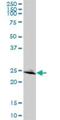 RAB32, Member RAS Oncogene Family antibody, H00010981-B01P, Novus Biologicals, Western Blot image 