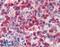 IKAROS Family Zinc Finger 1 antibody, 45-644, ProSci, Western Blot image 
