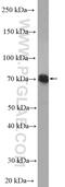 TNFAIP3 Interacting Protein 1 antibody, 15104-1-AP, Proteintech Group, Western Blot image 