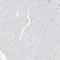 Solute Carrier Family 1 Member 5 antibody, HPA035240, Atlas Antibodies, Immunohistochemistry frozen image 