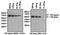 Estrogen Receptor 1 antibody, MA5-13191, Invitrogen Antibodies, Western Blot image 
