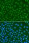 SSX Family Member 5 antibody, GTX55807, GeneTex, Immunocytochemistry image 