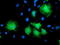 Katanin Regulatory Subunit B1 antibody, TA503807, Origene, Immunofluorescence image 