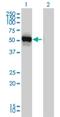 Glutamic--Pyruvic Transaminase antibody, H00002875-M03, Novus Biologicals, Western Blot image 