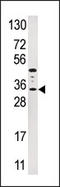 Insulin Like Growth Factor Binding Protein 3 antibody, AP14345PU-N, Origene, Western Blot image 