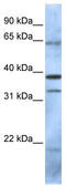 Polycomb Group Ring Finger 5 antibody, TA330483, Origene, Western Blot image 