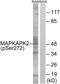 MAPK Activated Protein Kinase 2 antibody, AP55823PU-S, Origene, Western Blot image 