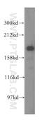 ERCC Excision Repair 6 Like, Spindle Assembly Checkpoint Helicase antibody, 15688-1-AP, Proteintech Group, Western Blot image 