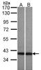 ArfGAP With Dual PH Domains 1 antibody, LS-C185807, Lifespan Biosciences, Western Blot image 