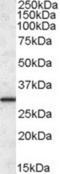 Endoplasmic Reticulum Protein 29 antibody, NBP1-05028, Novus Biologicals, Western Blot image 