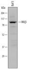 Inhibitor Of Nuclear Factor Kappa B Kinase Subunit Beta antibody, MAB7155, R&D Systems, Western Blot image 